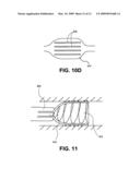 Methods and devices for eluting agents to a vessel diagram and image