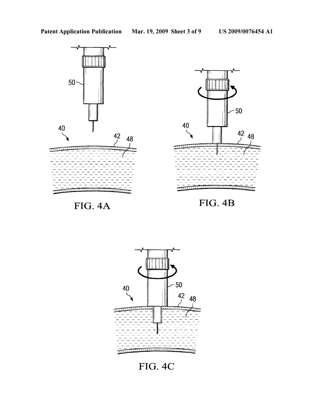 SYSTEM AND METHOD FOR PROVIDING AN OBTURATOR FOR ENHANCED DIRECTIONAL CAPABILITIES IN A VASCULAR ENVIRONMENT - diagram, schematic, and image 04