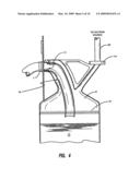 METHOD AND APPARATUS FOR DISPOSING OF LIQUID SURGICAL WASTE FOR PROTECTION OF HEALTHCARE WORKERS diagram and image