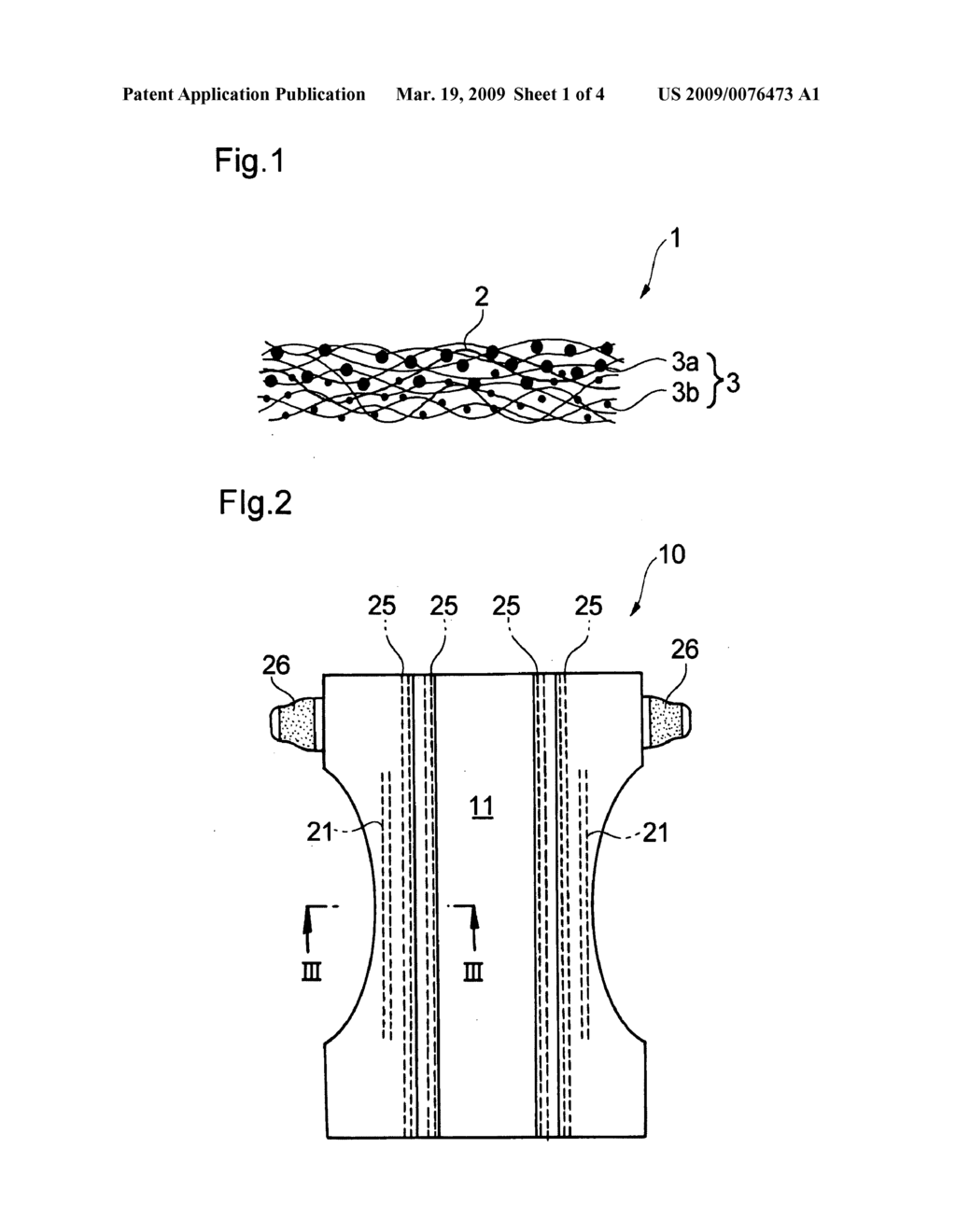 Absorbent Article - diagram, schematic, and image 02