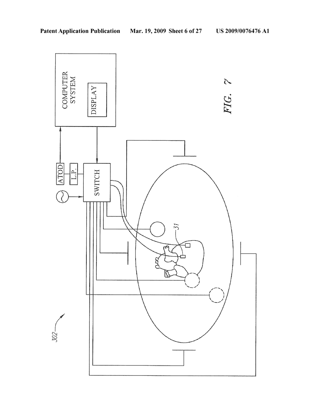 SYSTEMS AND METHODS EMPLOYING FORCE SENSING FOR MAPPING INTRA-BODY TISSUE - diagram, schematic, and image 07