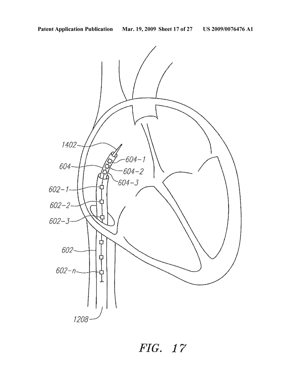 SYSTEMS AND METHODS EMPLOYING FORCE SENSING FOR MAPPING INTRA-BODY TISSUE - diagram, schematic, and image 18