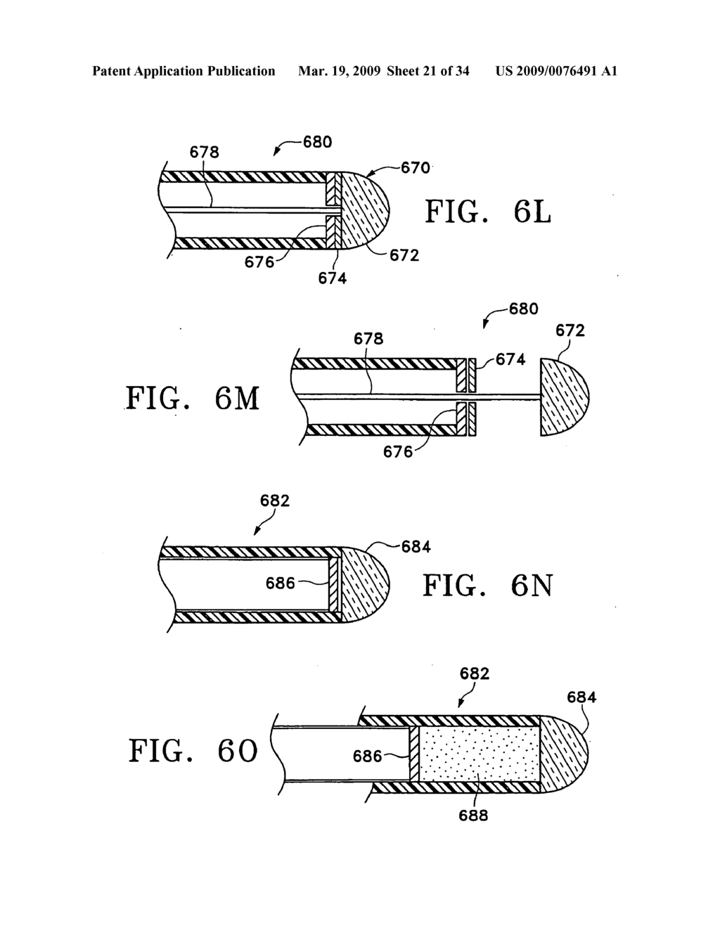 METHODS FOR MAINTAINING THE PATENCY OF COLLATERAL CHANNELS IN THE LUNGS USING CRYO-ENERGY - diagram, schematic, and image 22