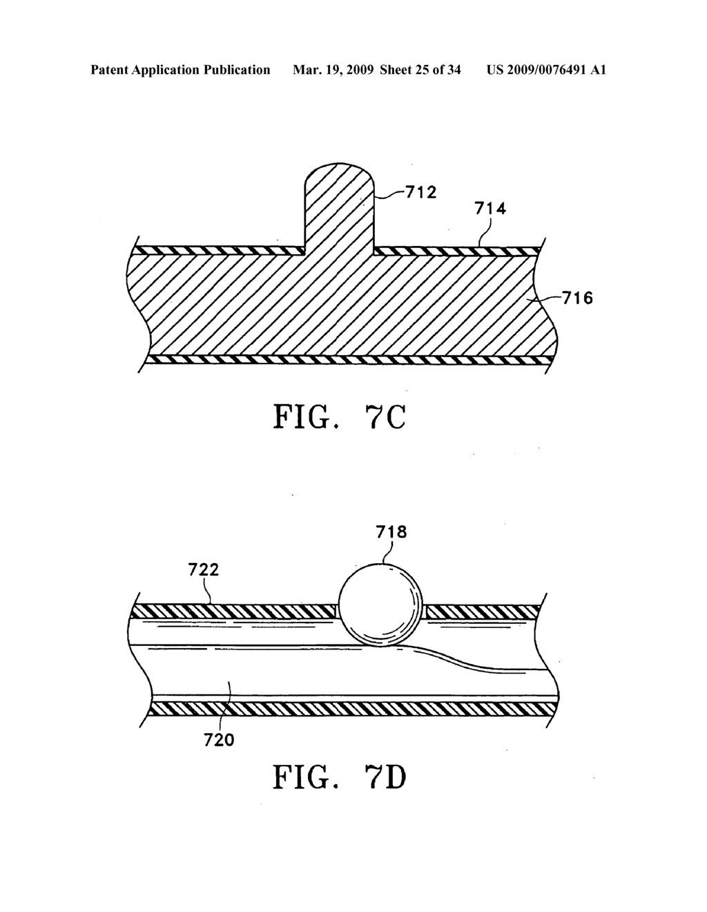 METHODS FOR MAINTAINING THE PATENCY OF COLLATERAL CHANNELS IN THE LUNGS USING CRYO-ENERGY - diagram, schematic, and image 26