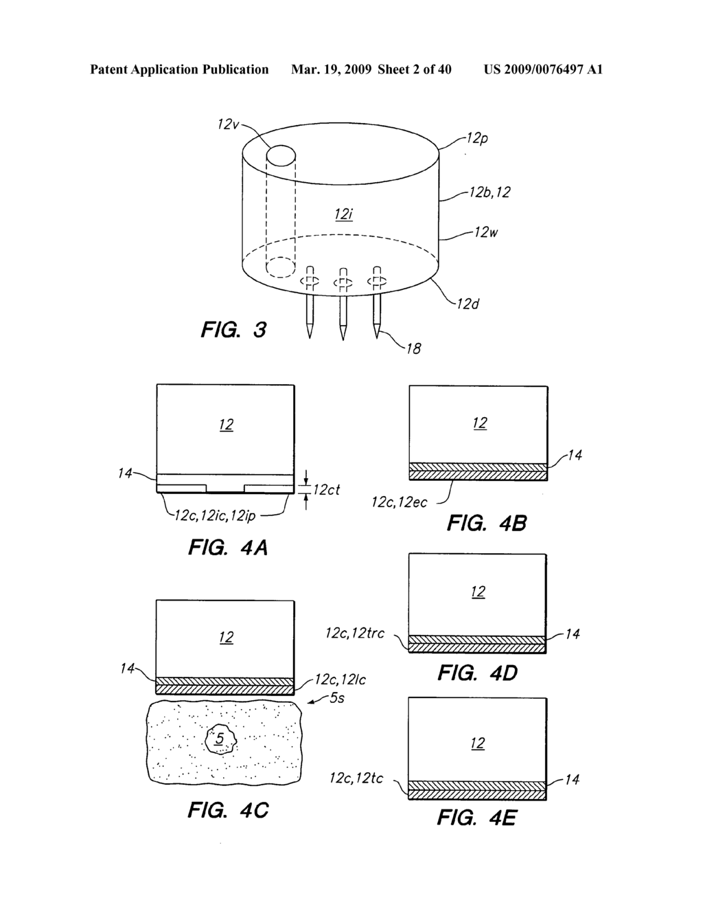 Tissue surface treatment apparatus and method - diagram, schematic, and image 03