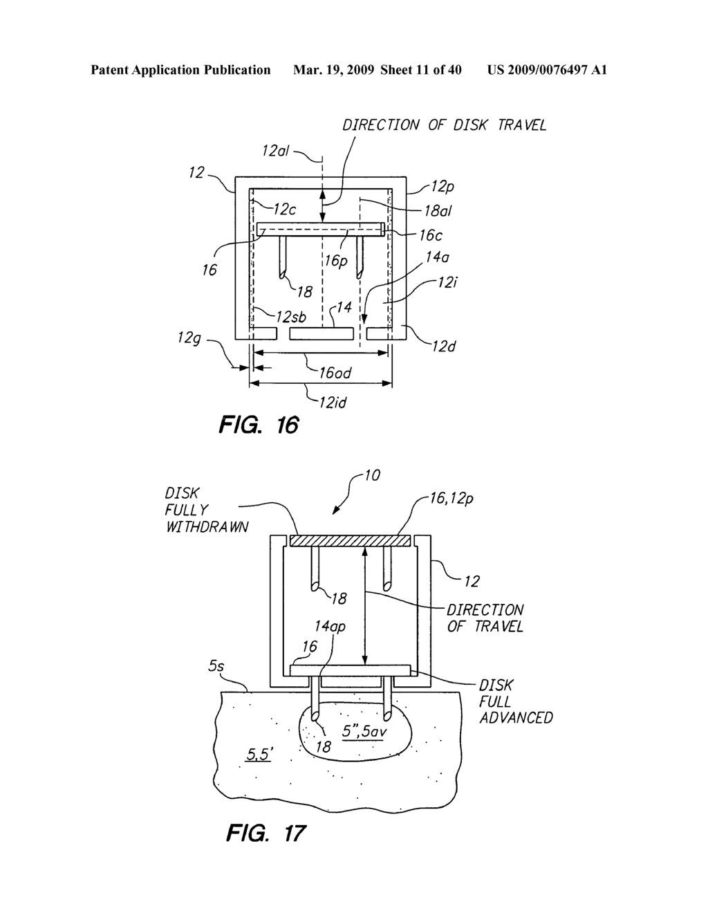 Tissue surface treatment apparatus and method - diagram, schematic, and image 12