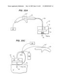 Tissue surface treatment apparatus and method diagram and image