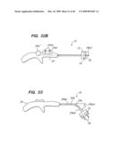 Tissue surface treatment apparatus and method diagram and image