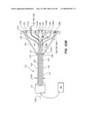 Tissue surface treatment apparatus and method diagram and image