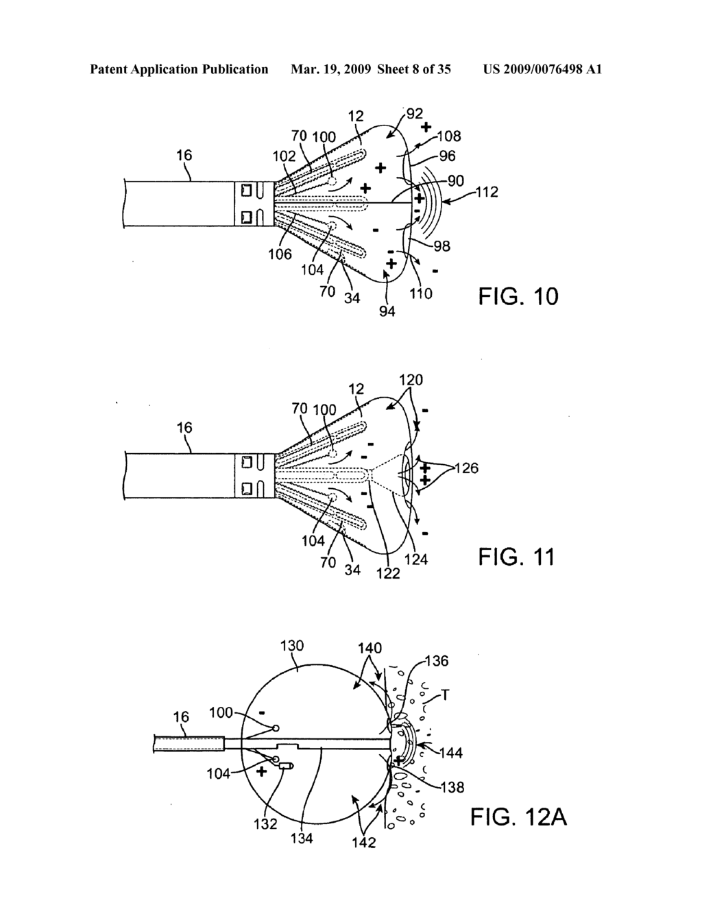 VISUALIZATION AND ABLATION SYSTEM VARIATIONS - diagram, schematic, and image 09