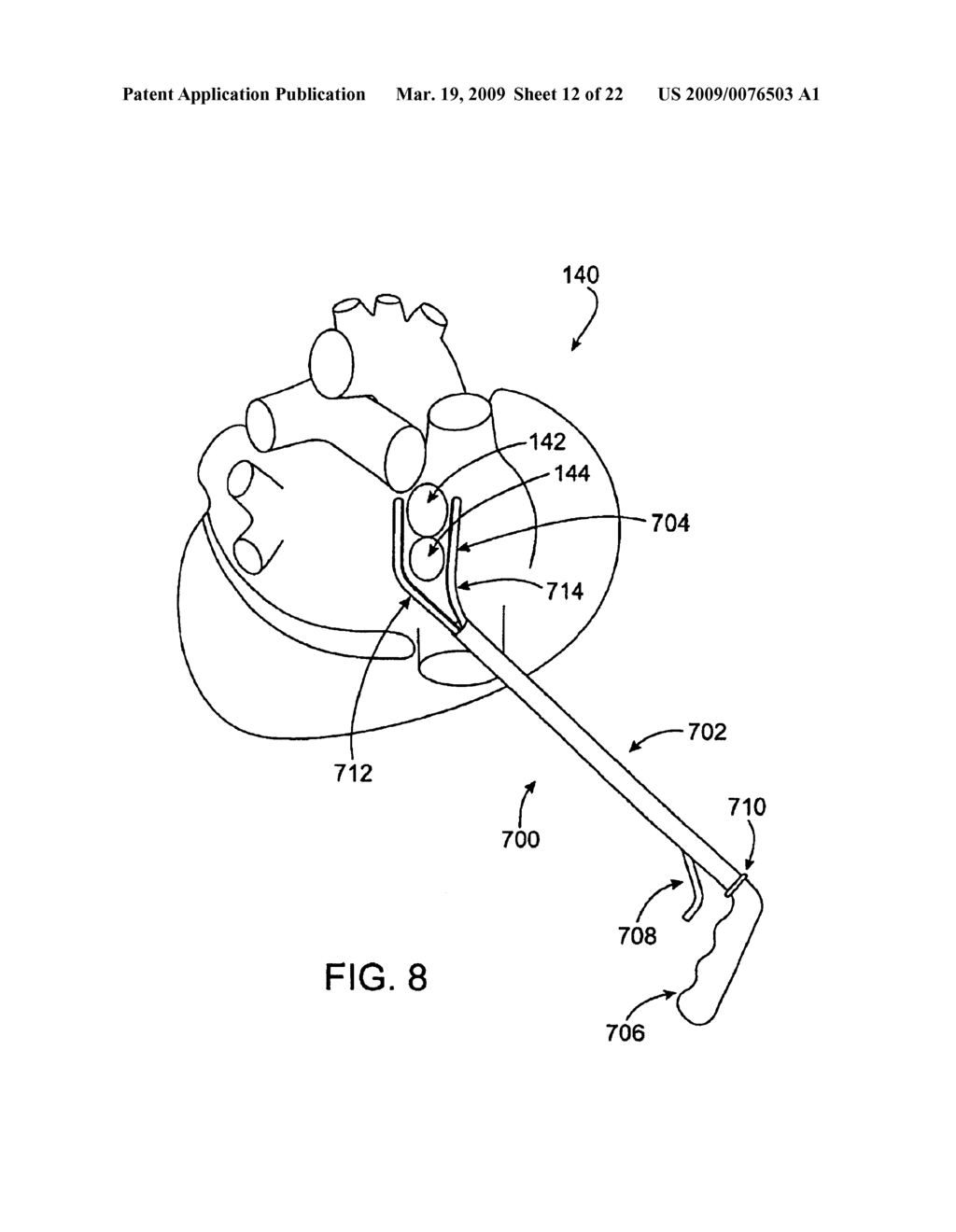 CONDUCTION BLOCK VERIFICATION PROBE AND METHOD OF USE - diagram, schematic, and image 13