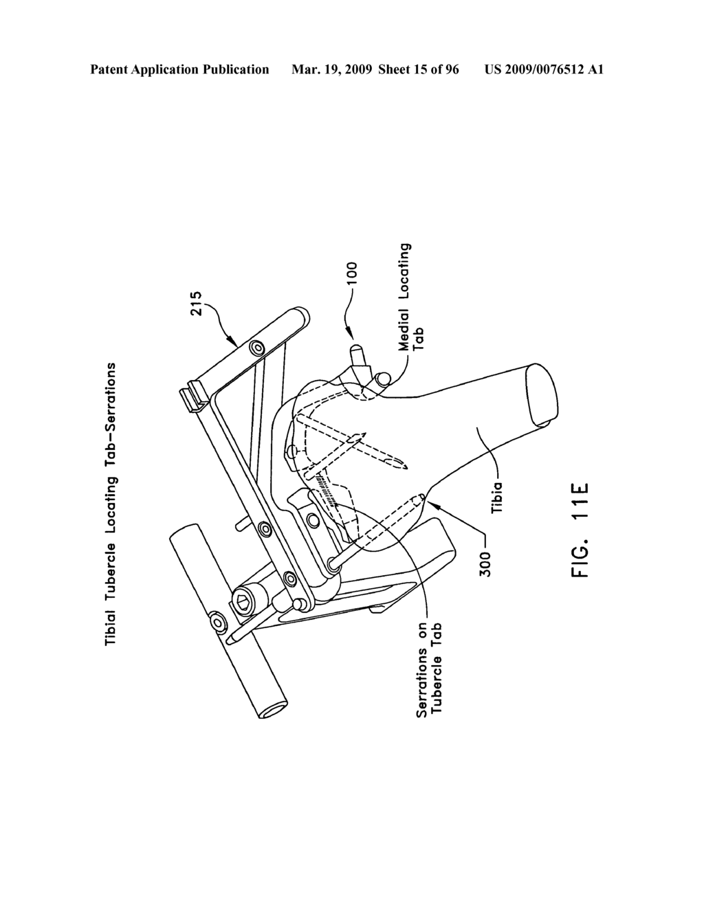 Method and apparatus for reconstructing a ligament and/or repairing cartilage, and for performing an open wedge, high tibial osteotomy - diagram, schematic, and image 16