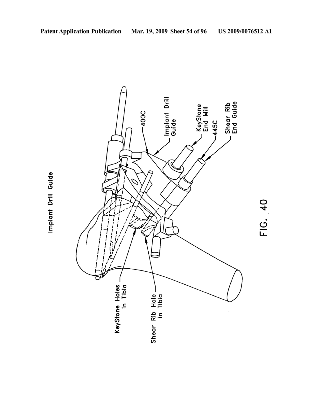 Method and apparatus for reconstructing a ligament and/or repairing cartilage, and for performing an open wedge, high tibial osteotomy - diagram, schematic, and image 55