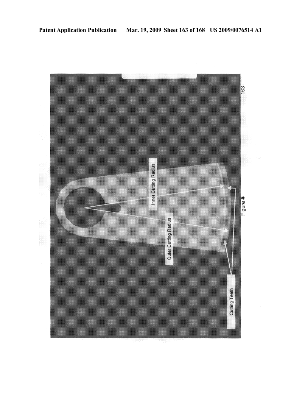 Methods and apparatus for improved profile based resection - diagram, schematic, and image 164