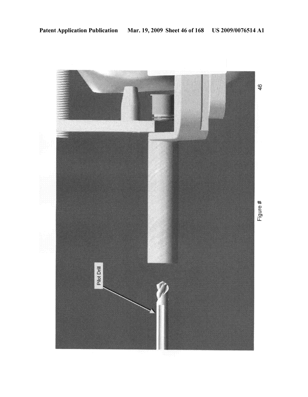 Methods and apparatus for improved profile based resection - diagram, schematic, and image 47