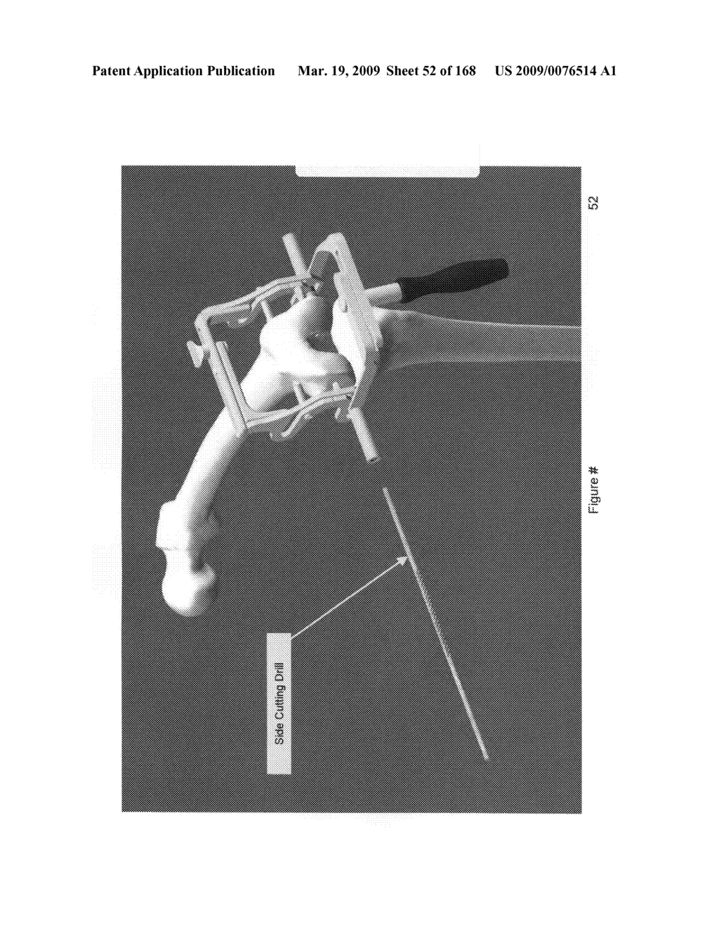 Methods and apparatus for improved profile based resection - diagram, schematic, and image 53