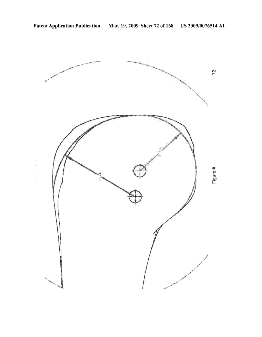 Methods and apparatus for improved profile based resection - diagram, schematic, and image 73