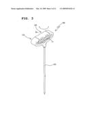 Apparatus For Treating Bone diagram and image