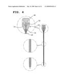 Apparatus For Treating Bone diagram and image