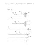 Apparatus For Treating Bone diagram and image