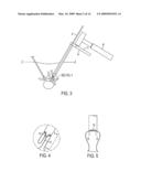 METHODS AND SURGICAL KITS FOR MINIMALLY-INVASIVE FACET JOINT FUSION diagram and image