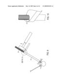 METHODS AND SURGICAL KITS FOR MINIMALLY-INVASIVE FACET JOINT FUSION diagram and image