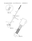 METHODS AND SURGICAL KITS FOR MINIMALLY-INVASIVE FACET JOINT FUSION diagram and image