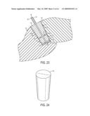 METHODS AND SURGICAL KITS FOR MINIMALLY-INVASIVE FACET JOINT FUSION diagram and image