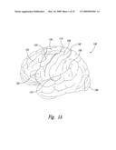 Electrode Configurations for Reducing Invasiveness and/or Enhancing Neural Stimulation Efficacy, and Associated Methods diagram and image