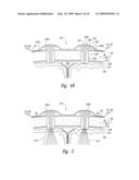 Electrode Configurations for Reducing Invasiveness and/or Enhancing Neural Stimulation Efficacy, and Associated Methods diagram and image