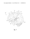 Electrode Configurations for Reducing Invasiveness and/or Enhancing Neural Stimulation Efficacy, and Associated Methods diagram and image