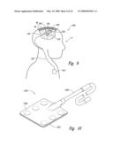 Electrode Configurations for Reducing Invasiveness and/or Enhancing Neural Stimulation Efficacy, and Associated Methods diagram and image