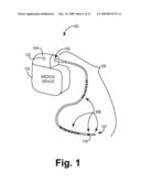 MEDICAL ELECTRICAL LEAD diagram and image