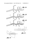 EXPANDABLE DEVICE FOR TREATMENT OF A STRICTURE IN A BODY VESSEL diagram and image