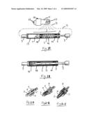 System for mechanical adjustment of medical implants diagram and image