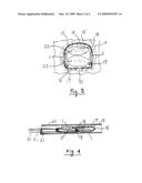 System for mechanical adjustment of medical implants diagram and image