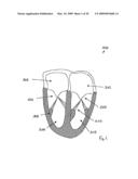 Medical device suitable for use in treatment of a valve diagram and image