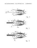 Medical device suitable for use in treatment of a valve diagram and image