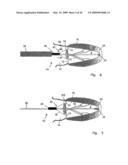 Medical device suitable for use in treatment of a valve diagram and image