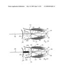 Medical device suitable for use in treatment of a valve diagram and image