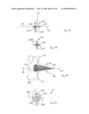 Medical device suitable for use in treatment of a valve diagram and image