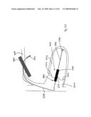 Medical device suitable for use in treatment of a valve diagram and image