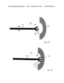 Medical device suitable for use in treatment of a valve diagram and image