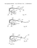 Medical device suitable for use in treatment of a valve diagram and image