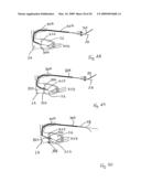 Medical device suitable for use in treatment of a valve diagram and image