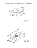 Medical device suitable for use in treatment of a valve diagram and image