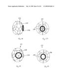 Medical device suitable for use in treatment of a valve diagram and image