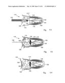 Medical device suitable for use in treatment of a valve diagram and image