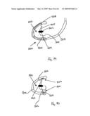 Medical device suitable for use in treatment of a valve diagram and image