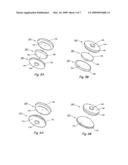 Intervertebral disc replacement prosthesis diagram and image